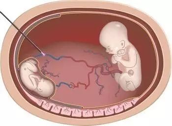 伊万娜 产品图片