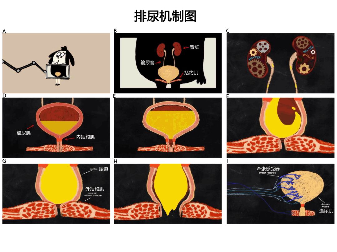 伊尼舍林的报丧女妖